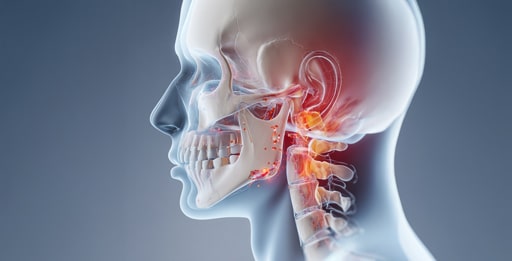When Nighttime Grinding Destroys Your Jaw: The Hidden Path from Bruxism to TMJ Arthritis